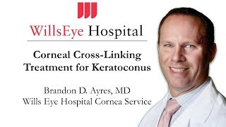 Corneal Crosslinking Treatment for Keratoconus [upl. by Nospmis]