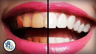 Whats The Best Way To Whiten Teeth [upl. by Enehs]