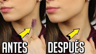 COMO QUITAR UN CHUPETON DEL CUELLO  TRUCOS DE MAQUILLAJE  LAURA MEJIA [upl. by Niloc]