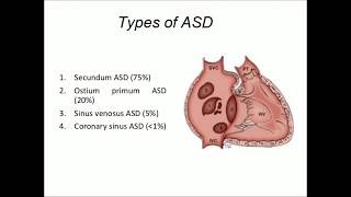 Sinus Venosus Atrial Septal Defect [upl. by Downey]