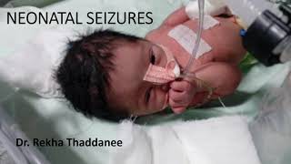 Neonatal Seizures  Pediatrics [upl. by Viglione]