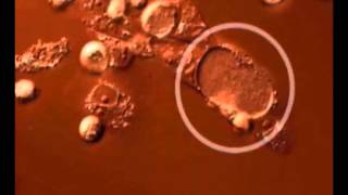 Time lapse video of the Chlamydia trachomatis developmental cycle [upl. by Lain]