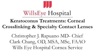 Keratoconus Treatments Corneal Crosslinking amp Specialty Contact Lenses [upl. by Lime]