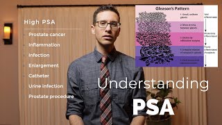 What PSA is and why its important explained by urologist [upl. by Ydrah]