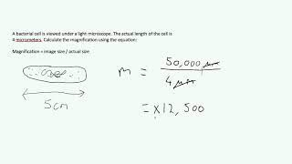 Microscopes amp Magnification  Exam Question AQA GCSE Biology [upl. by Seka]