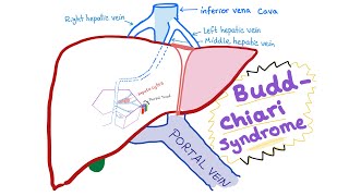 HallermannStreiff Syndrome Fewer than 200 Known Cases [upl. by Raji]