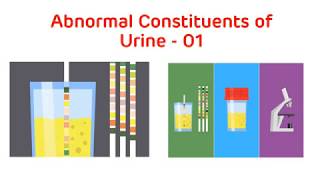 Analysis of Abnormal Urine  Abnormal Urine Constituents Practical Part I  Biochemistry Practical [upl. by Aira498]