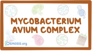 Mycobacterium avium complex  causes symptoms diagnosis treatment pathology [upl. by Sille475]