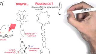 Understanding Parkinson’s Disease [upl. by Tsui]