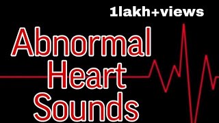 Abnormal Heart Sounds  MisMedicine [upl. by Hujsak14]