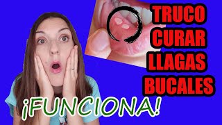 Cómo CURAR LLAGAS en la BOCA RÁPIDO cómo CURAR LLAGAS en la LENGUA remedios caserosAFTAS BUCALES🤕 [upl. by Neeleuqcaj490]