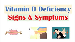 Vitamin D Deficiency Signs amp Symptoms ex Fatigue Diagnosis Treatment [upl. by Brackely]