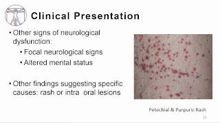 1 Overview meningitis and encephalitis [upl. by Bedwell]