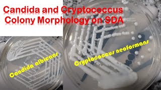 Candida and Cryptococcus colony morphology on SDA [upl. by Driskill]