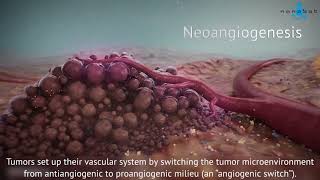 Tumor growth  3D medical animation [upl. by Phyllys]