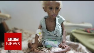 Yemen On the brink of starvation  BBC News [upl. by Winnifred]