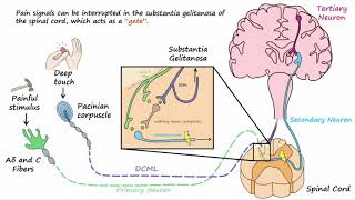 Central Pontine Myelinolysis  LockedIn Syndrome [upl. by Anair]