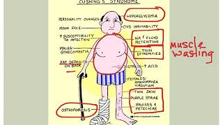 Endocrine Disorders [upl. by Percival]