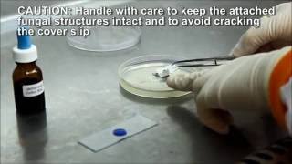 Slide Culture and Lactophenol Cotton Blue Staining [upl. by Ahsinaj959]