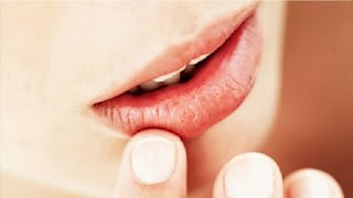 The Basics Canker Sore Causes and Treatments [upl. by Htnicayh]