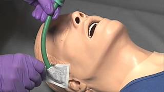 Nasopharyngeal Airway [upl. by Atiuqrehs]