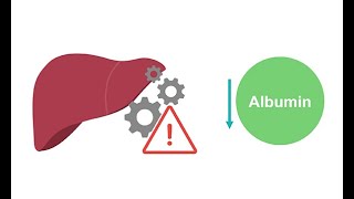 Getting to know albumin physiology [upl. by Amarillis589]