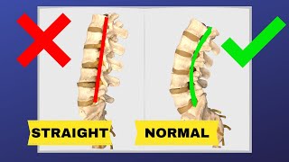 How To Correct Straightening Of Lumbar Spine FIX LOSS OF LUMBAR LORDOSIS  Dr Walter Salubro [upl. by Eliades813]