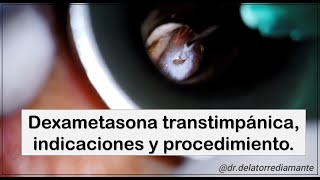 Dexametasona transtimpánica Indicaciones y procedimiento [upl. by Hera577]