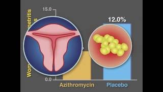 PostCesarean Infection and Antibiotic Prophylaxis  NEJM [upl. by Ettigirb72]