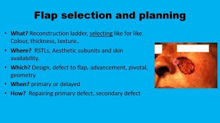 11 Facial flaps The Basics [upl. by Kleon724]