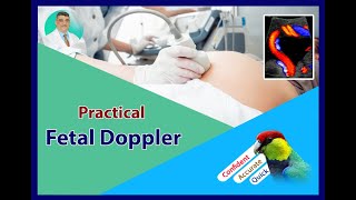 Practical Obstetric Doppler  Ductus Venosus [upl. by Valdis]